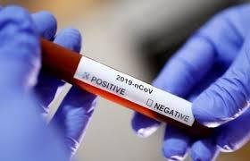 İdman jurnalistinin anası koronavirusdan dünyasını dəyişdi