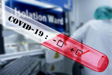 Azərbaycanda daha 106 nəfərdə koronavirus aşkarlandı – 2 NƏFƏR VƏFAT ETDİ