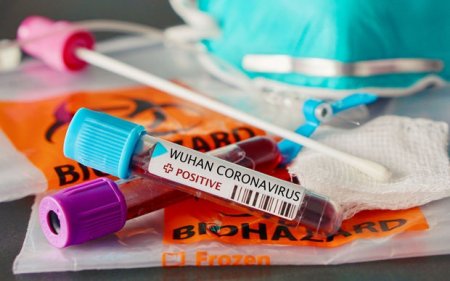 Şamaxıda koronavirus xəstələrinin tullantılarının kəndə atılması ilə bağlı RƏSMİ AÇIQLAMA