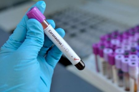 Dünyada koronavirusdan sağalanların sayı 17 milyonu keçdi - STATİSTİKA