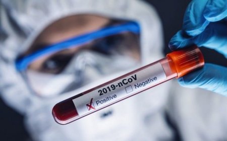 Azərbaycanda koronavirusa yoluxanların sayı azaldı - Ölənlər var